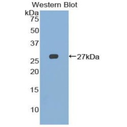 Natural Killer Cell Receptor 2B4 (CD244) Antibody