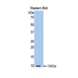 Nitric Oxide Synthase, Inducible (NOS2) Antibody