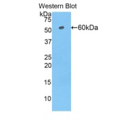 abx103658