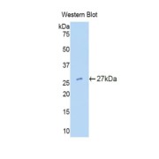 Western blot analysis of the recombinant protein.