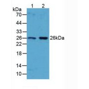 Western blot analysis of (1) Human Liver Tissue and (2) Human Lung Tissue.