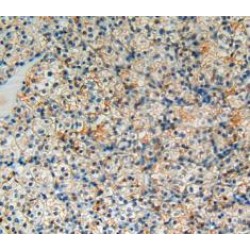 B-Cell CLL/Lymphoma 2 Like Protein (Bcl2L) Antibody