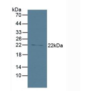 Western blot analysis of recombinant Human Bid.
