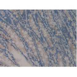 Cartilage Oligomeric Matrix Protein (COMP) Antibody