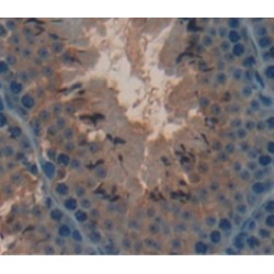 Cartilage Oligomeric Matrix Protein (COMP) Antibody