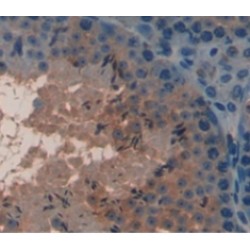 Cartilage Oligomeric Matrix Protein (COMP) Antibody