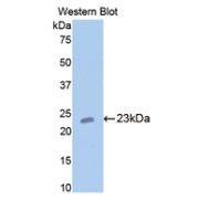 abx103698