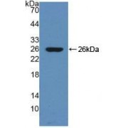 Western blot analysis of recombinant Rat CHRM1.