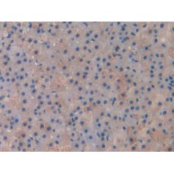 Cholinergic Receptor, Muscarinic 1 (CHRM1) Antibody