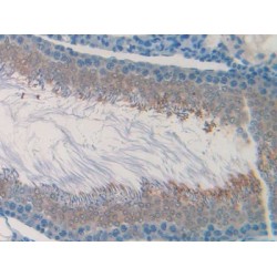 Cholinergic Receptor, Muscarinic 1 (CHRM1) Antibody