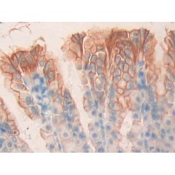 Cholinergic Receptor, Muscarinic 1 (CHRM1) Antibody