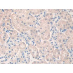 Cholinergic Receptor, Muscarinic 1 (CHRM1) Antibody