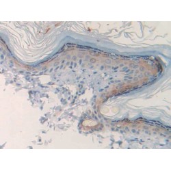 Cholinergic Receptor, Muscarinic 1 (CHRM1) Antibody