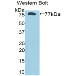 Deiodinase, Iodothyronine, Type III (DIO3) Antibody