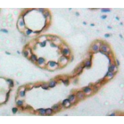 Receptor Tyrosine-Protein Kinase ErbB-2 (ERBB2) Antibody