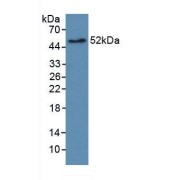 Western blot analysis of recombinant Human EGFR2.