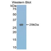 Western blot analysis of the recombinant protein.
