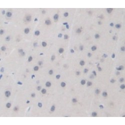 Isocitrate Dehydrogenase 1, Soluble (IDH1) Antibody