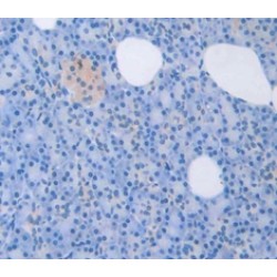 Left/Right Determination Factor 1 (LEFTY1) Antibody