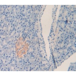 Left/Right Determination Factor 1 (LEFTY1) Antibody