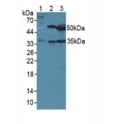 Western blot analysis of (1) Mouse Sp2/0 Cells, (2) Mouse Liver Tissue and (3) Mouse Pancreas Tissue.