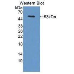 Leucine Rich Alpha-2-Glycoprotein 1 (LRG1) Antibody
