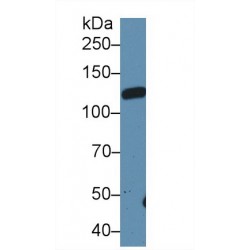Leukemia Inhibitory Factor Receptor (LIFR) Antibody