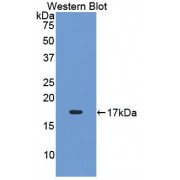 Western blot analysis of recombinant Rat LIFR.