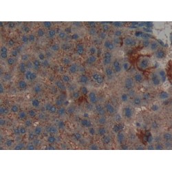 Leukemia Inhibitory Factor Receptor (LIFR) Antibody