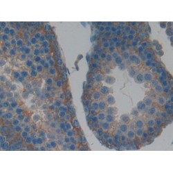 Leukemia Inhibitory Factor Receptor (LIFR) Antibody