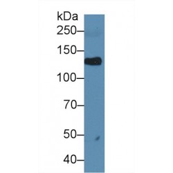 Leukemia Inhibitory Factor Receptor (LIFR) Antibody