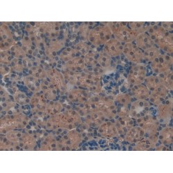 Leukemia Inhibitory Factor Receptor (LIFR) Antibody