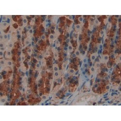 Leukemia Inhibitory Factor Receptor (LIFR) Antibody