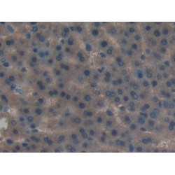 Leukemia Inhibitory Factor Receptor (LIFR) Antibody