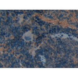 Leukemia Inhibitory Factor Receptor (LIFR) Antibody