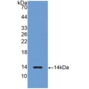WB analysis of recombinant Rat LHB Protein.