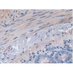 Mitogen-Activated Protein Kinase 8 / JNK1 (MAPK8) Antibody