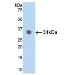 Mitogen-Activated Protein Kinase 9 / JNK2 (MAPK9) Antibody