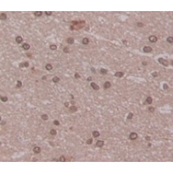 Mitogen-Activated Protein Kinase 9 / JNK2 (MAPK9) Antibody