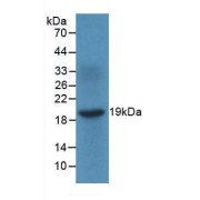 Western blot analysis of recombinant Human MIg.