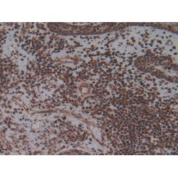 Phospholipase A2 Activating Protein (PLAA) Antibody
