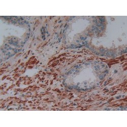 Phospholipase A2 Activating Protein (PLAA) Antibody