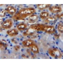Platelet Derived Growth Factor AA (PDGFAA) Antibody