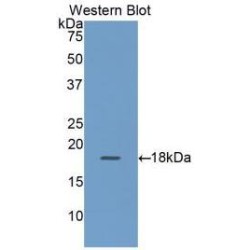 Retinol Binding Protein 2, Cellular (RBP2) Antibody