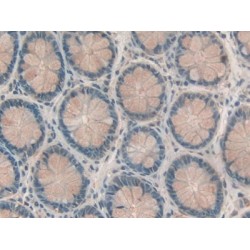 Retinol Binding Protein 2, Cellular (RBP2) Antibody