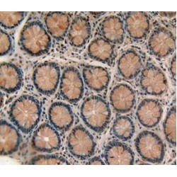 Retinol Binding Protein 2, Cellular (RBP2) Antibody