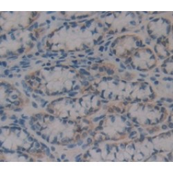 Retinol Binding Protein 2, Cellular (RBP2) Antibody