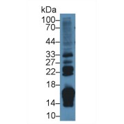 Western blot analysis of Rat Small intestine lysate, using Rat RBP2 Antibody (2 µg/ml) and HRP-conjugated Goat Anti-Rabbit antibody (<a href="https://www.abbexa.com/index.php?route=product/search&amp;search=abx400043" target="_blank">abx400043</a>, 0.2 µg/ml).