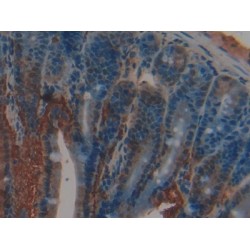 Retinol Binding Protein 2, Cellular (RBP2) Antibody