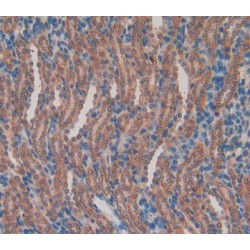 Retinol Binding Protein 2, Cellular (RBP2) Antibody